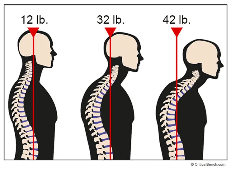 forward-head-posture2