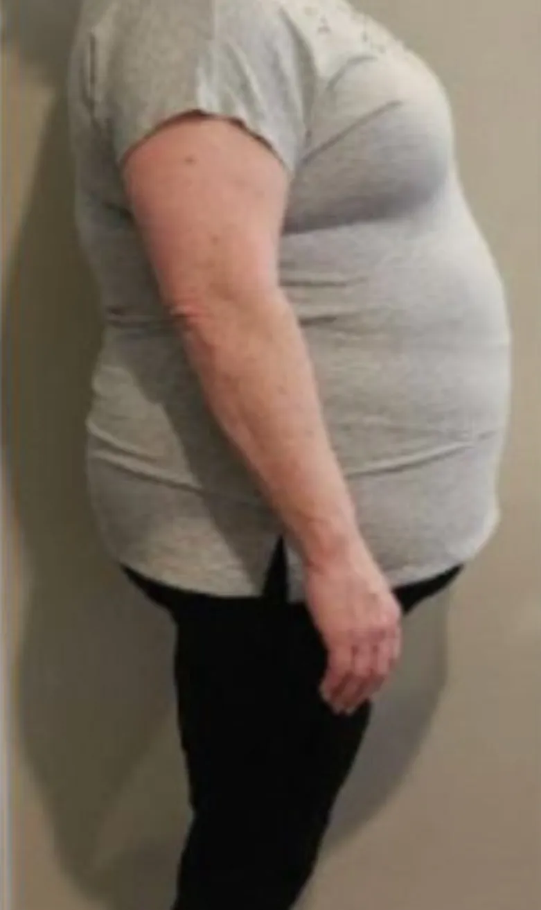 DANA before starting the program