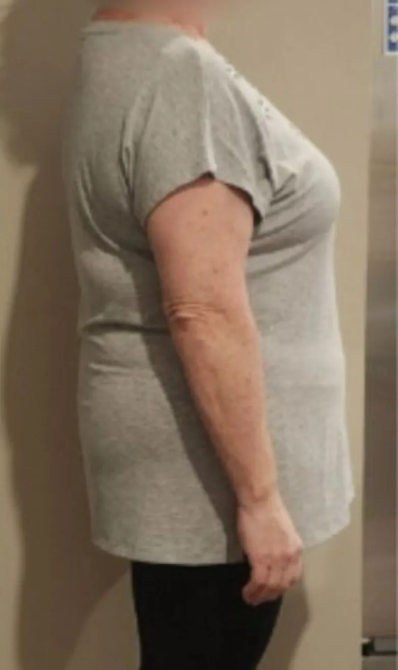 DANA after 10 weeks in Amy's program