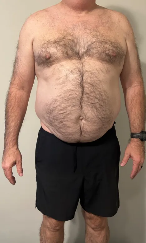 JIM before starting the program