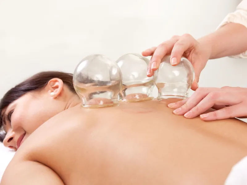 Thai combo cupping at Suriyo Thai Massage