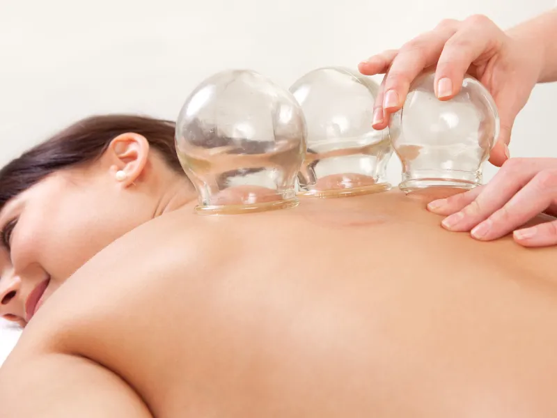 Thai combo cupping at Suriyo Thai massage