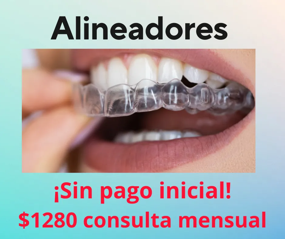 Alineadores dentales