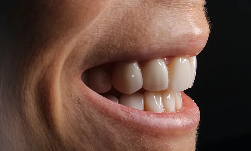 Full & Partial Dentures