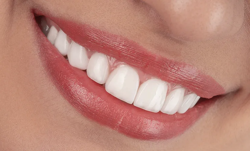 Cosmetic Dentistry