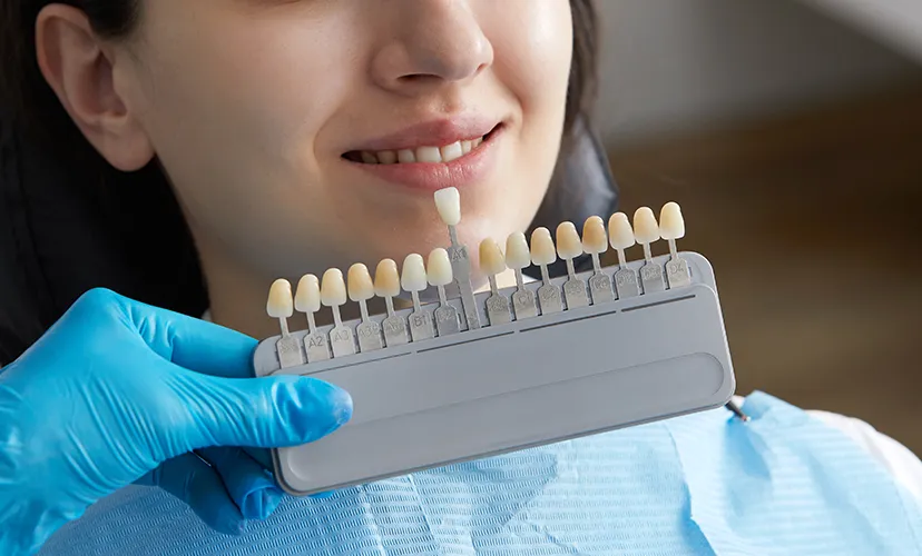 Teeth Whitening