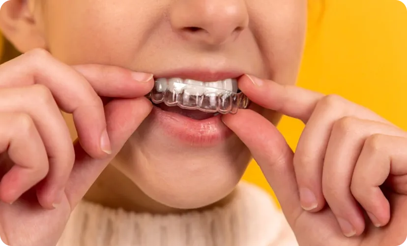 Invisalign & Orthodontics