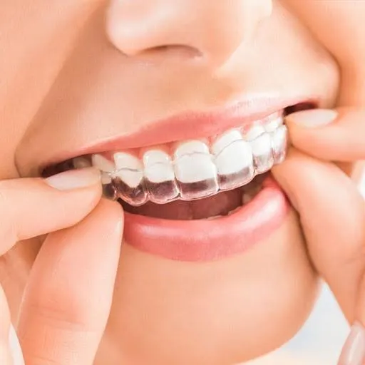 Invisalign Napa California - Hello Ortho