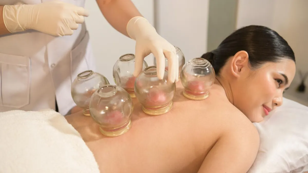 Circular marks on skin after cupping therapy for tension release