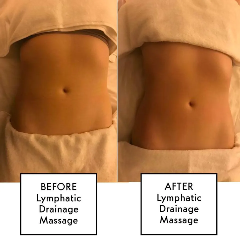 Post-surgery swelling reduction with lymphatic massage session