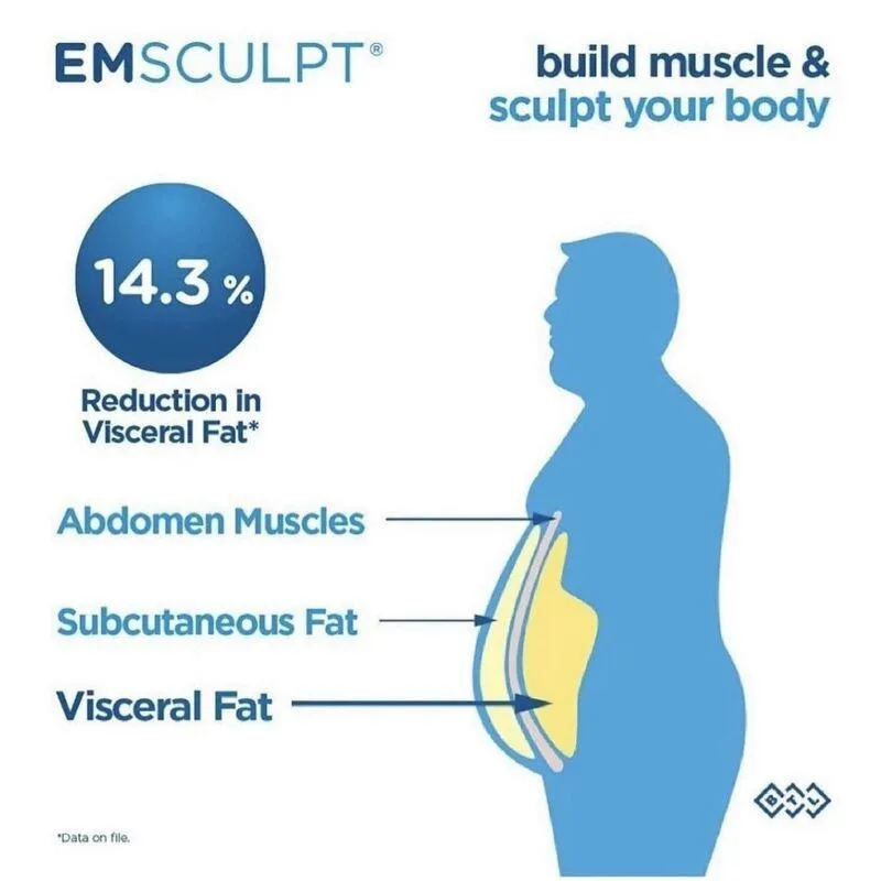 EmSculpt - Build Muscle and Sculpt Your Body