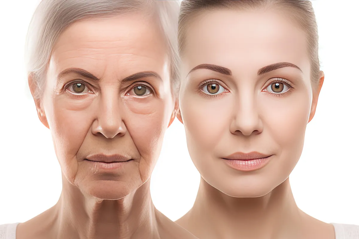 Anti-Aging