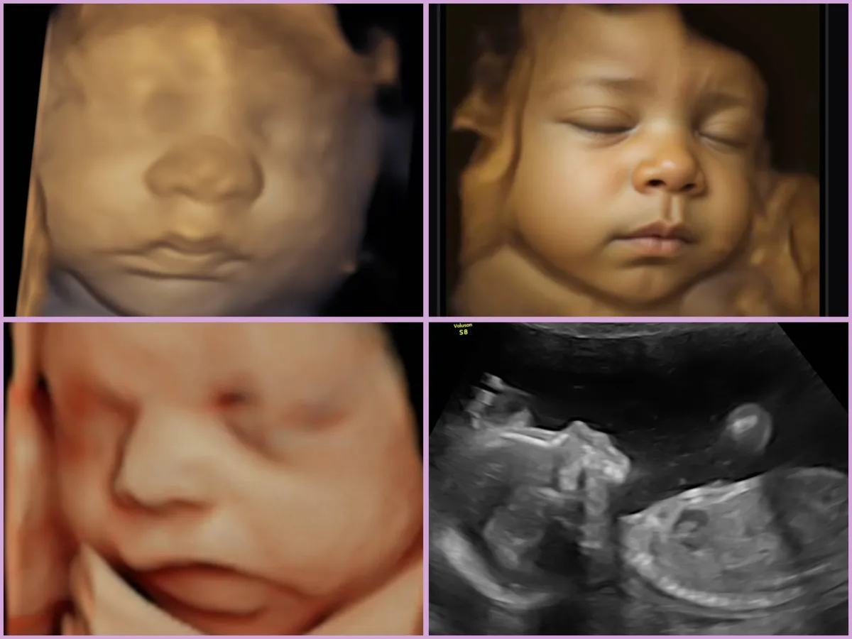 baby in pink and white tank top lying on green and blue mat
