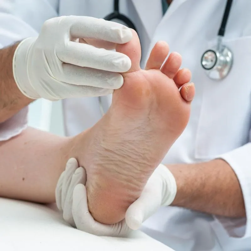 Diabetic Foot Care