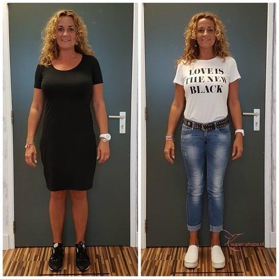 before after image 2