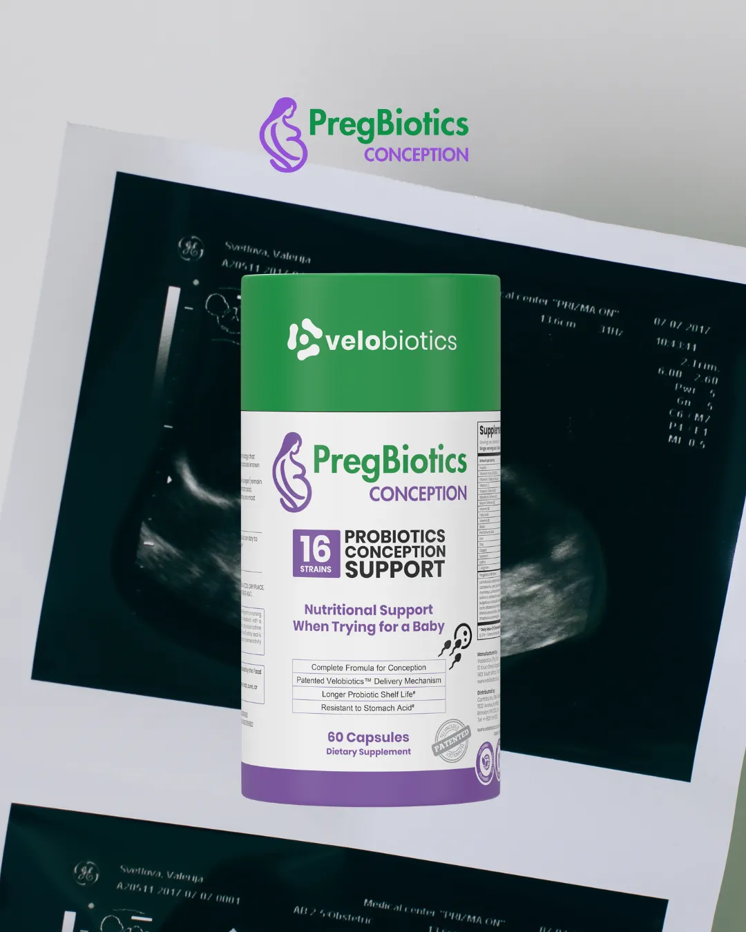 Why Gut Health Matters When Trying to Conceive
