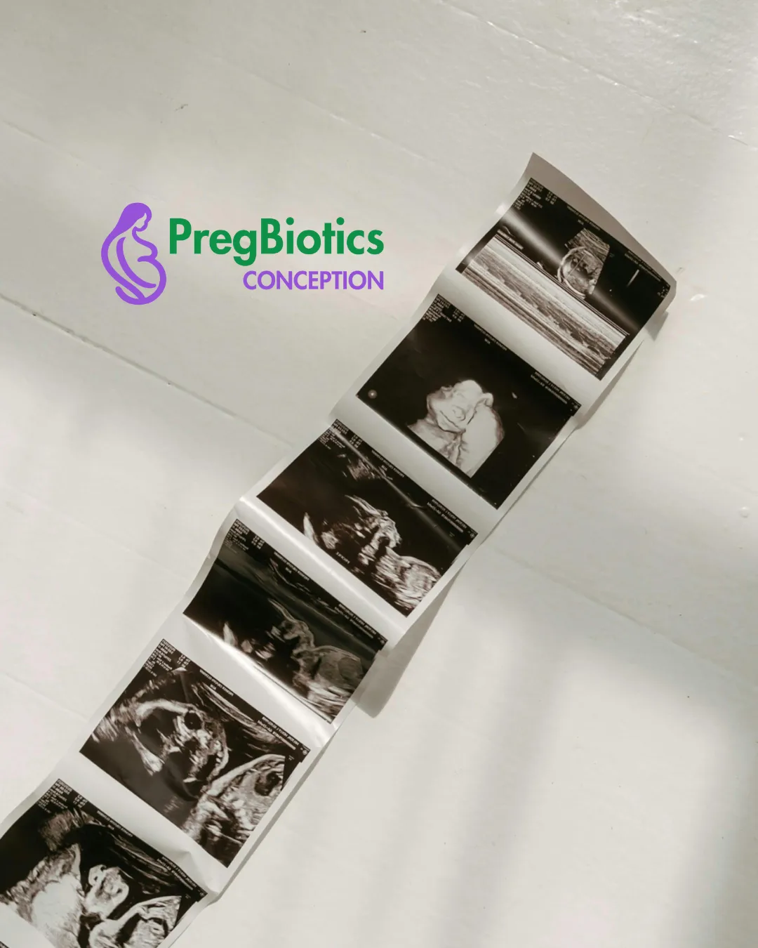 Beyond Nutrients: The Overlooked Dimension of Maternal Wellness