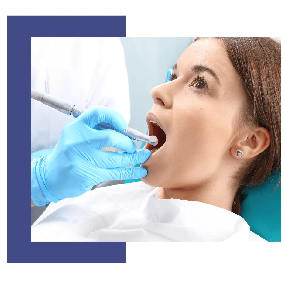 Dental services whitening