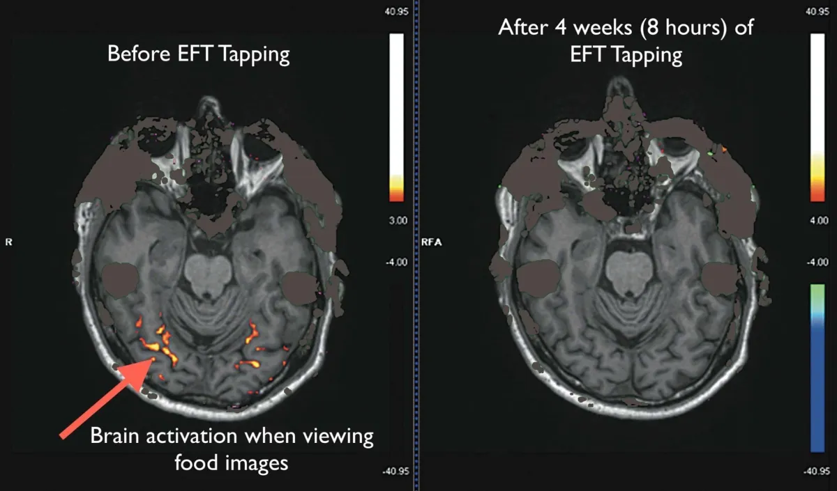 FMRI Study of EFT Tapping for Cravings