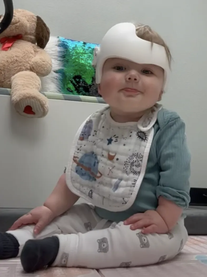 Plagiocephaly