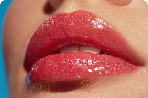 A soft and natural approach to lip shape and fullness. Clients choose this option for refined definition rather than dramatic size changes.