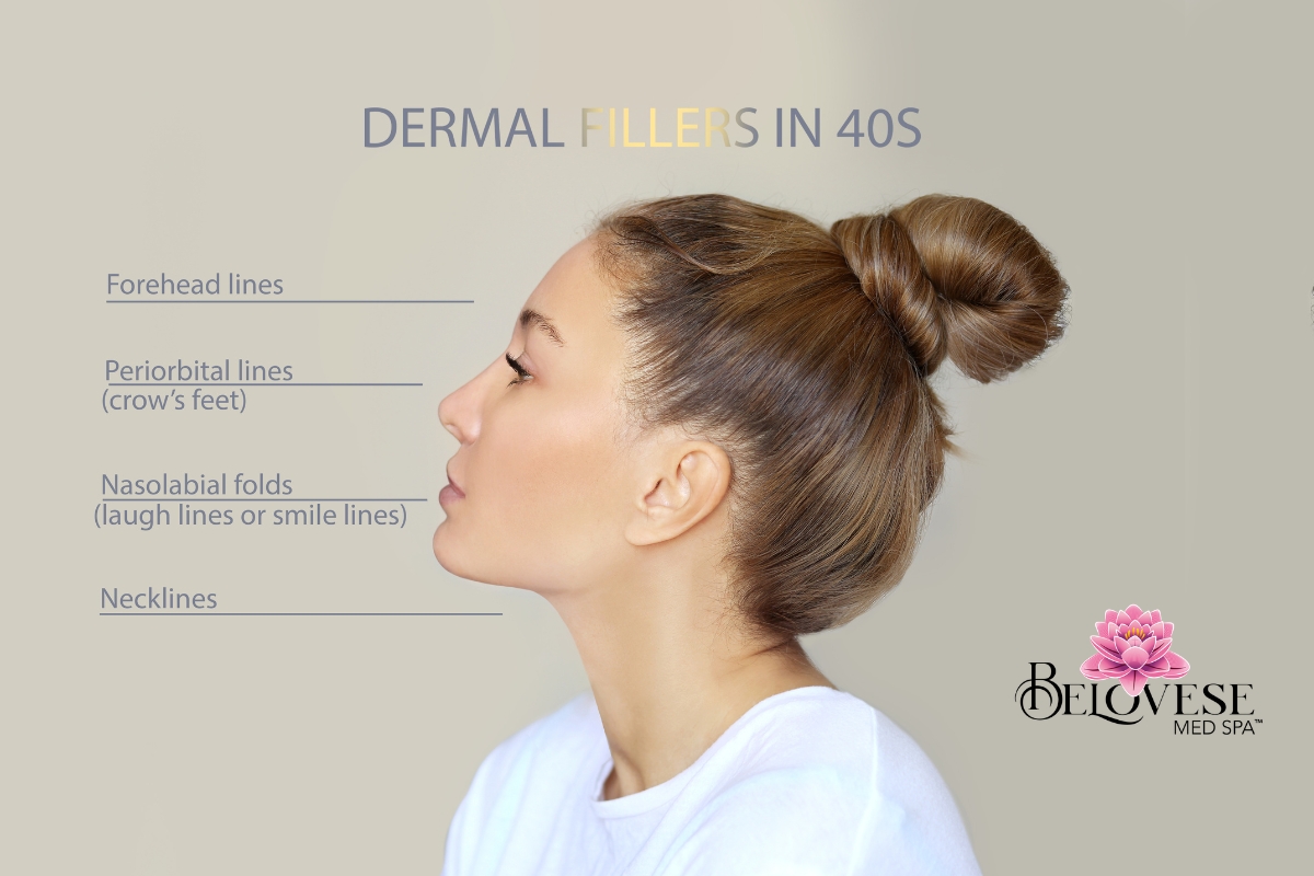 Dermal Fillers