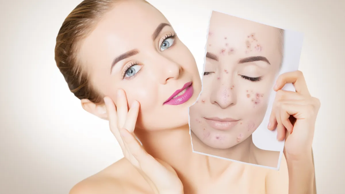 Comparing Profhilo and Rejuran skin boosters: Discover which treatment offers the best solution for hydration, skin rejuvenation, and overall skin health.