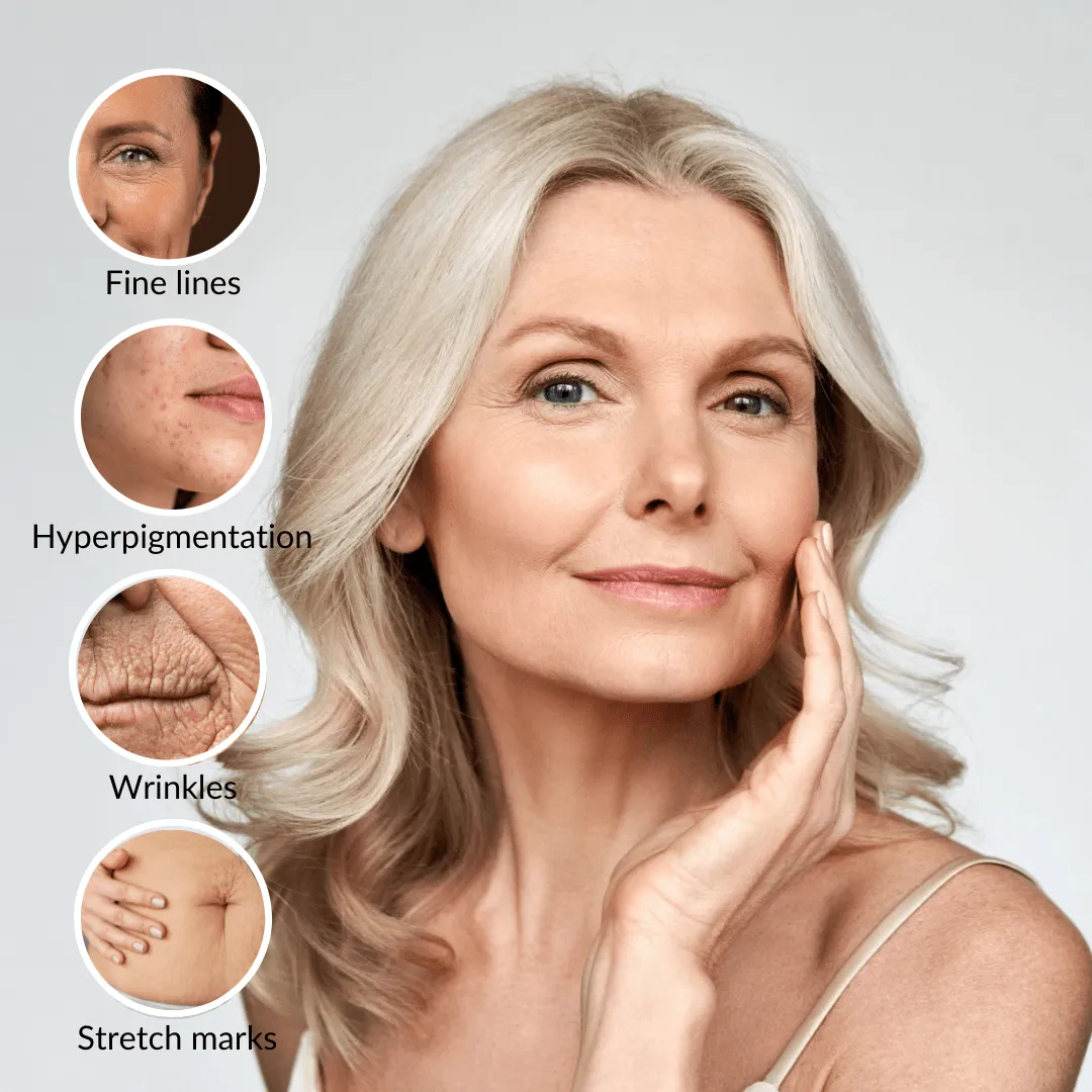 benefits of microchanneling