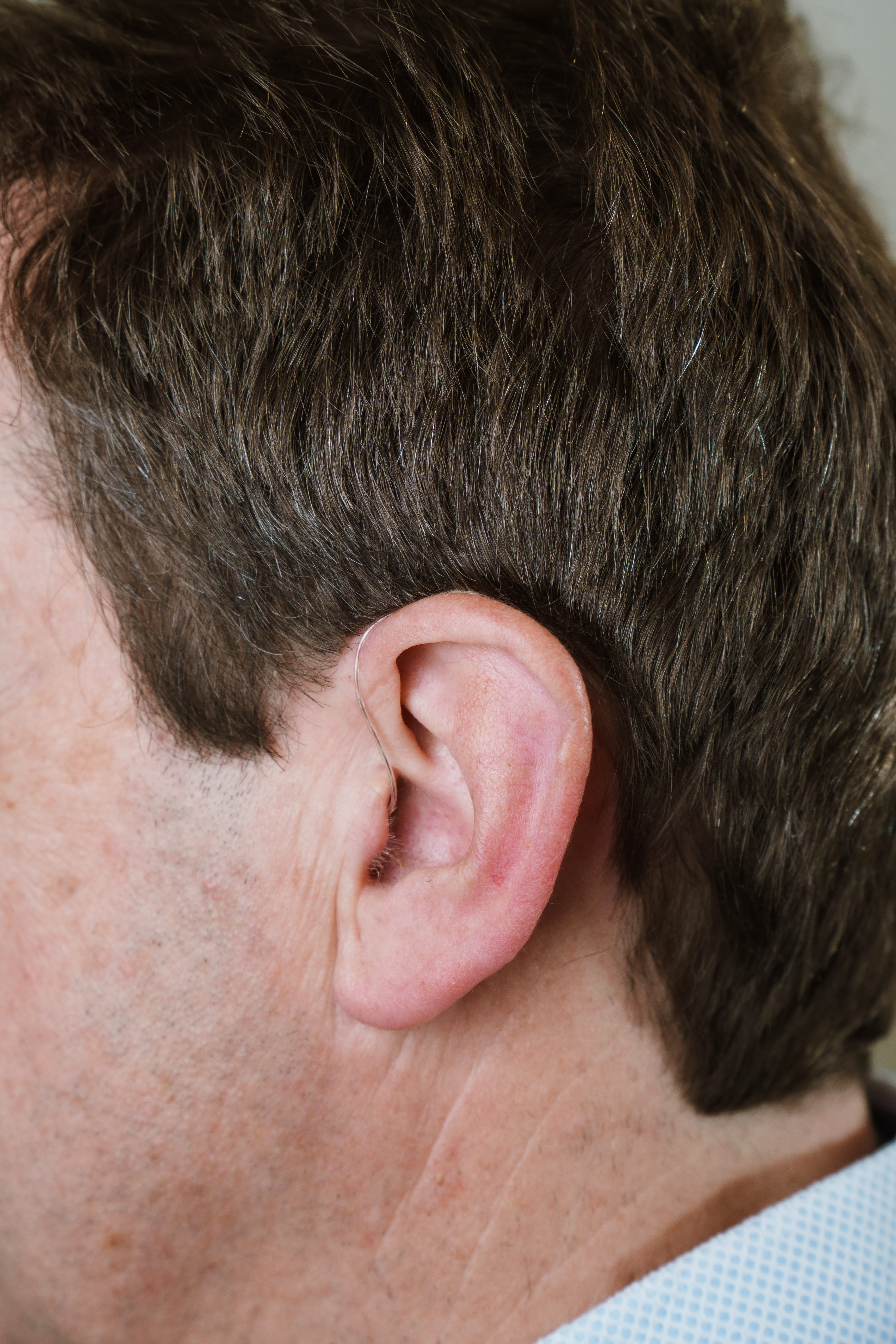 Ansicht des Hinterkopfs eines Mannes mit einem Hinter dem Ohr Hörgerät