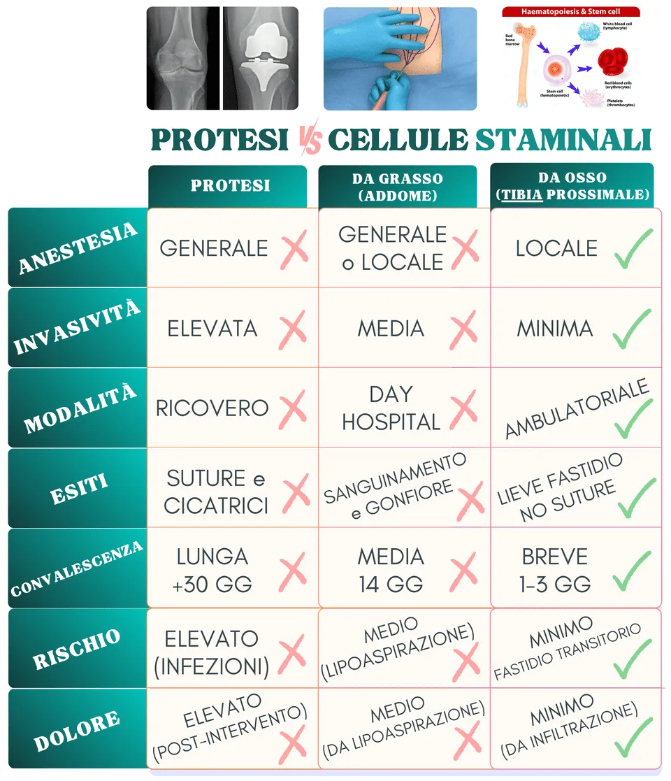 Tabella che compara l'utilizzo di protesi vs cellule staminali da grasso e la soluzione più sicura e meno invasiva le cellule staminali mesenchimali prelevate da tibia