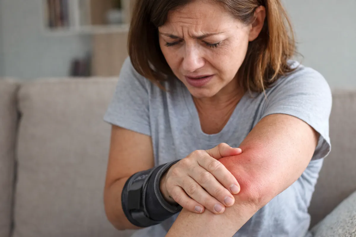 Donna di circa 40 anni con espressione dolorante che tiene il gomito arrossato e infiammato con una mano, indossando un tutore, in ambiente domestico sfocato.