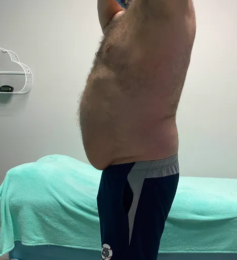 Client transformation after several sessions.