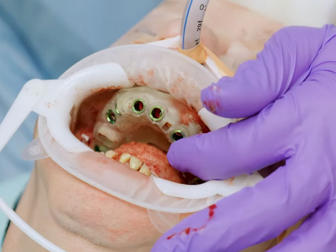 Teaching FP1 dental course at Smile Systems