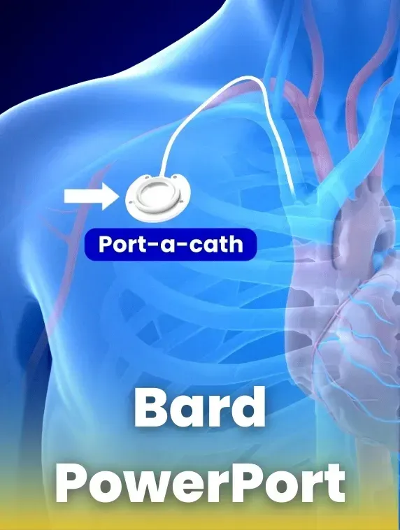 Bard PowerPort Lawsuit - Eric E Cardenas