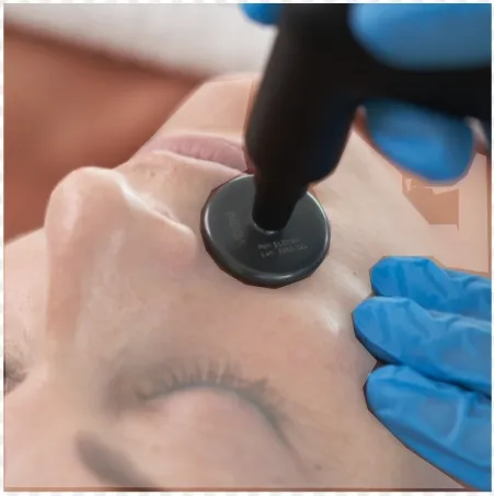 Indiba Therapy & Acupuncture for Sinus Pressure: Breathe Easy