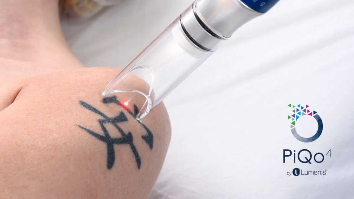 PiQo4 laser technology effectively removes all common colors tattoos,  either amateur or professional. This new technology targets both large and  small... | By MAC Skin 皮肤美学管理中心Facebook