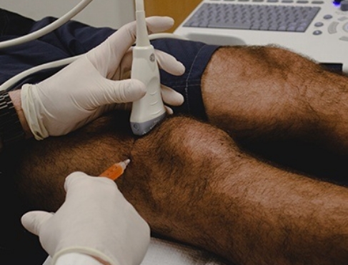 Ultrasound-guided regenerative therapy injection for knee pain in Florissant, MO