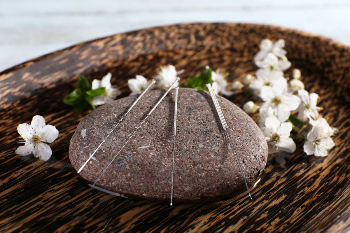 Close-up of acupuncture needles used to restore energy balance and reduce inflammation