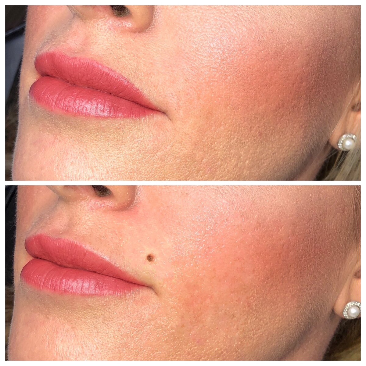 Jacksonville, FL Beauty Marks