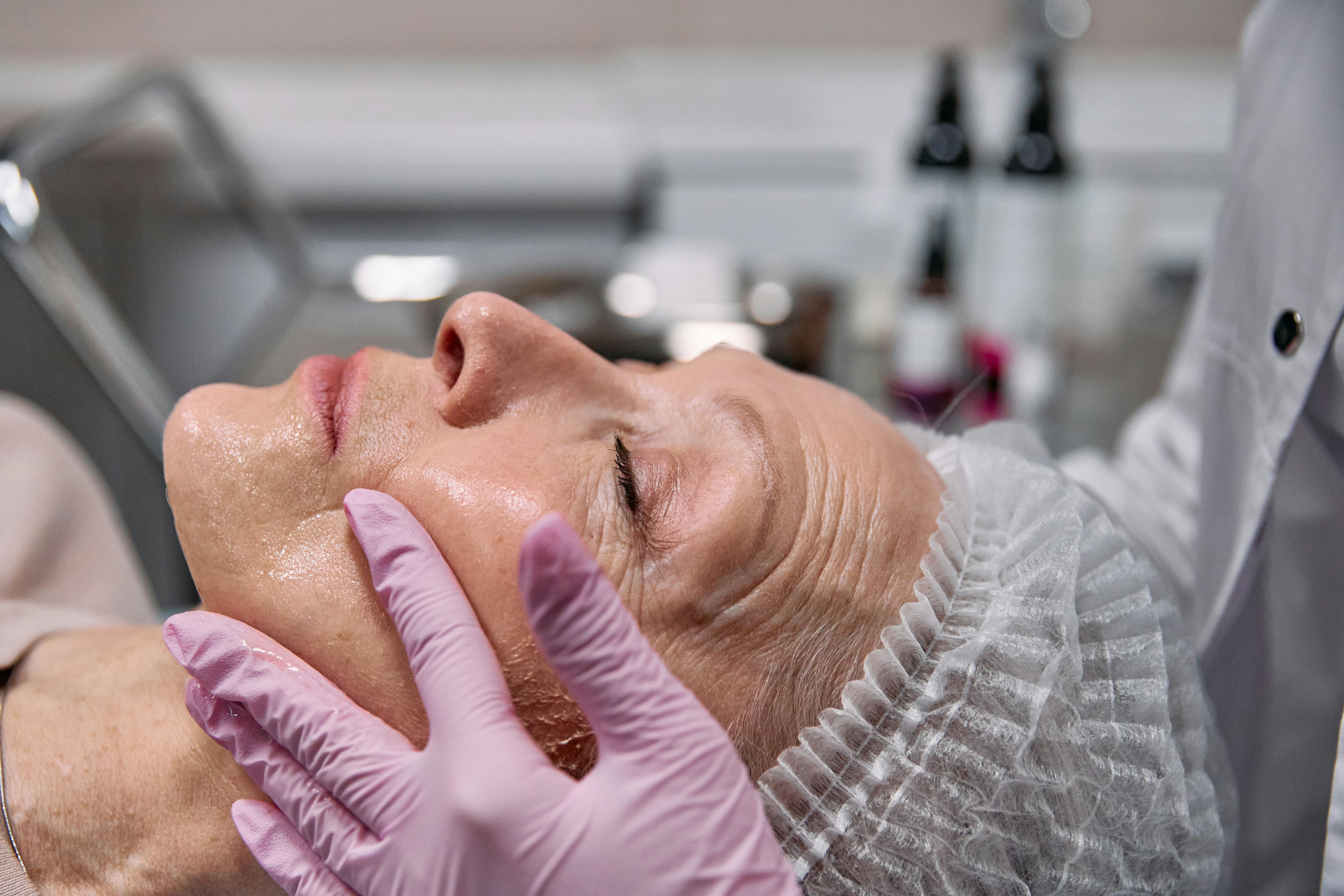 Facial rejuvenation treatment with a professional applying product to a woman’s face in a clinical aesthetic setting, highlighting skin texture and anti-aging care.