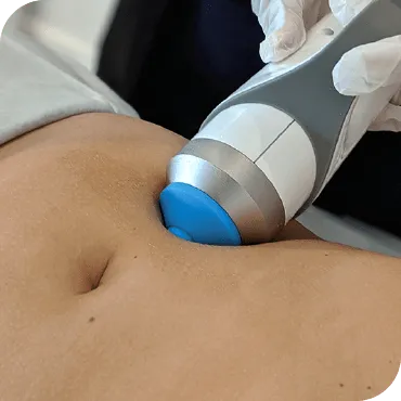 a grassy field with trees in the background