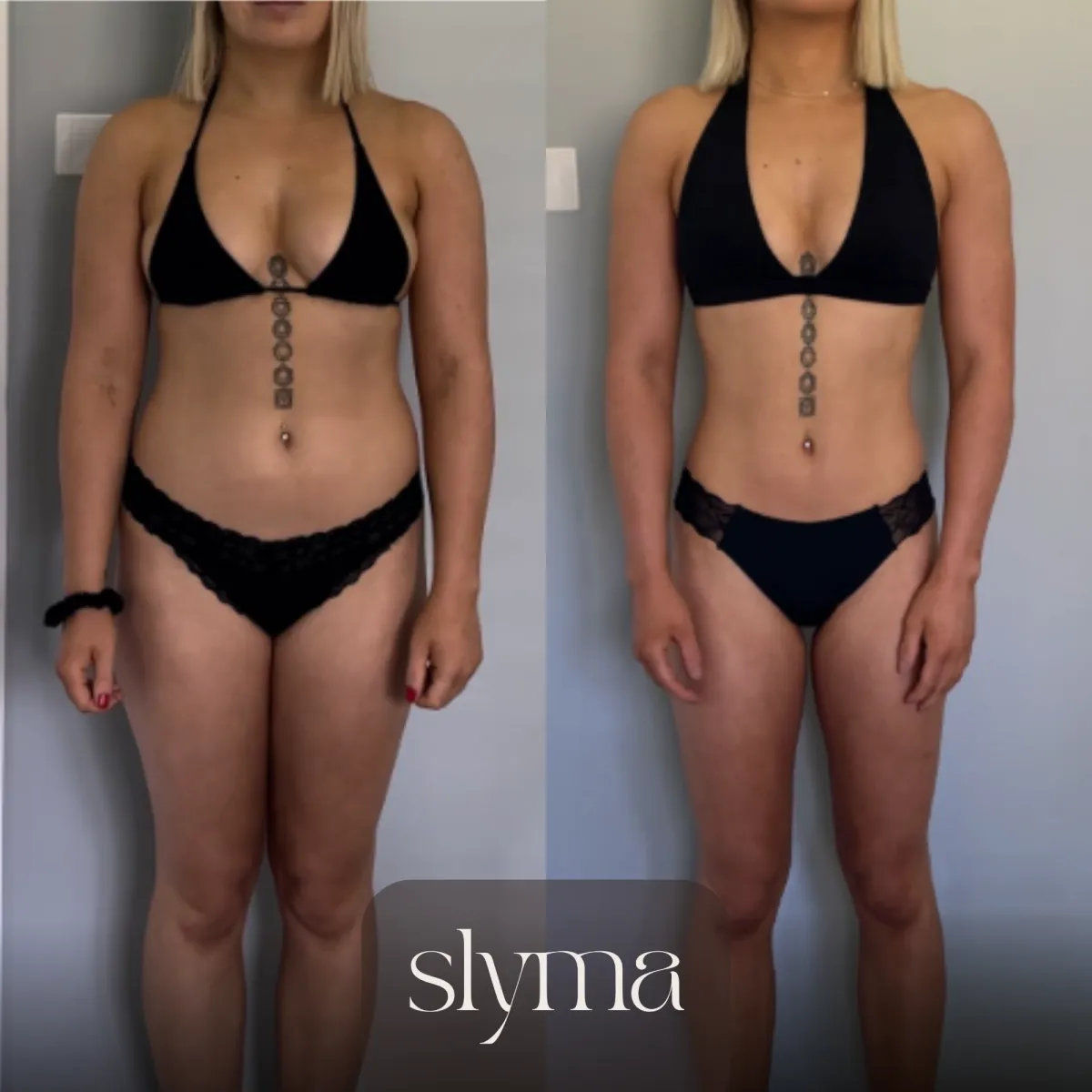 Slyma client transformation