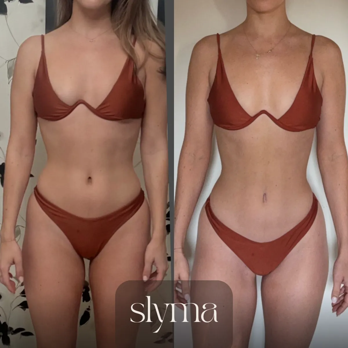 Slyma client transformation