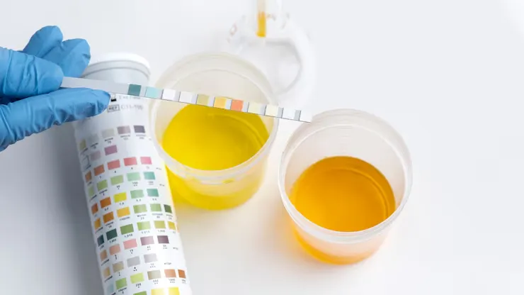 engine oil types