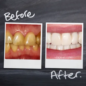 See before and after photos of Dr. Birch's patients