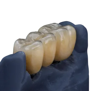 Dental bridges in Grand Junction, CO 