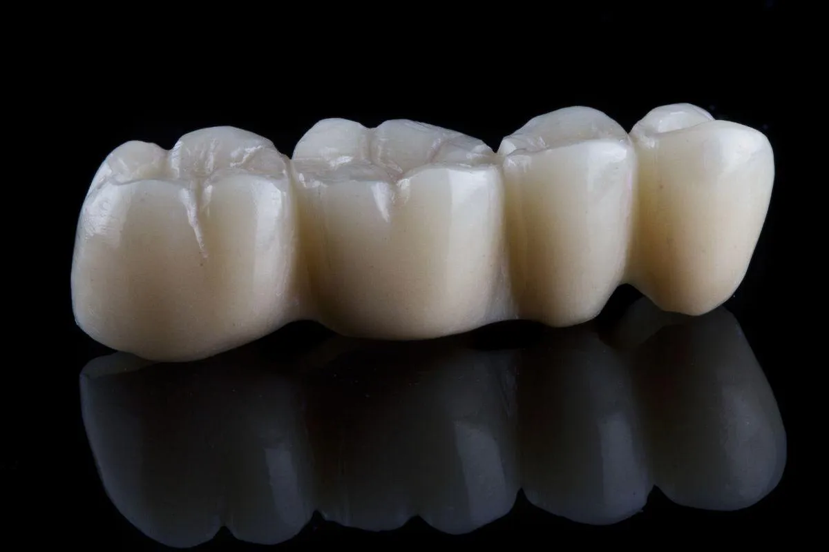 dental bridge Grand Junction dental office