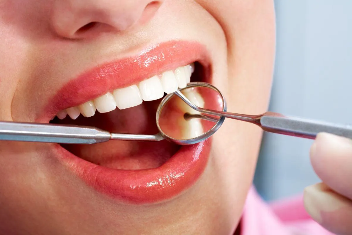 professional dental cleanings by dental hygienists in Grand Junction's best dental office