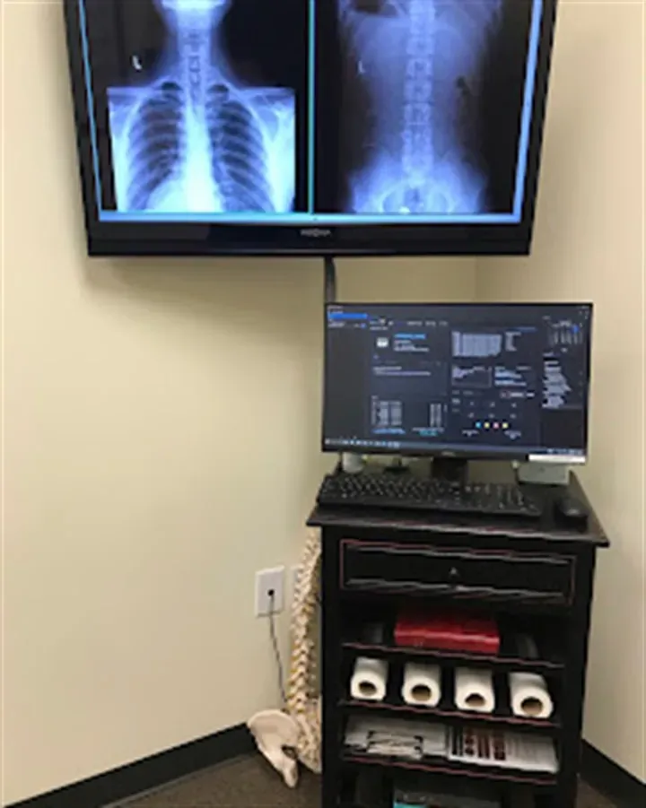Digital X-ray spinal imaging station at Champion Chiropractic & Spinal Injury in Clive, Iowa