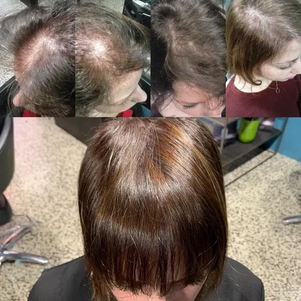 Protocollo FORCE: La Scienza della Ricrescita Capelli a Verona e San Marino